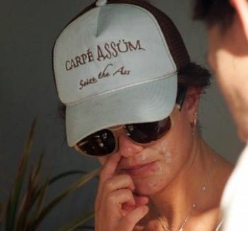 actress having pimples
