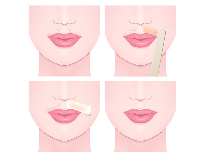 How To Remove Upper Lip Hair At Home