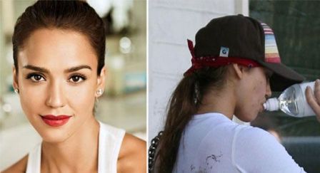 actresses in pimples
