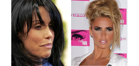 famous actresses with acne