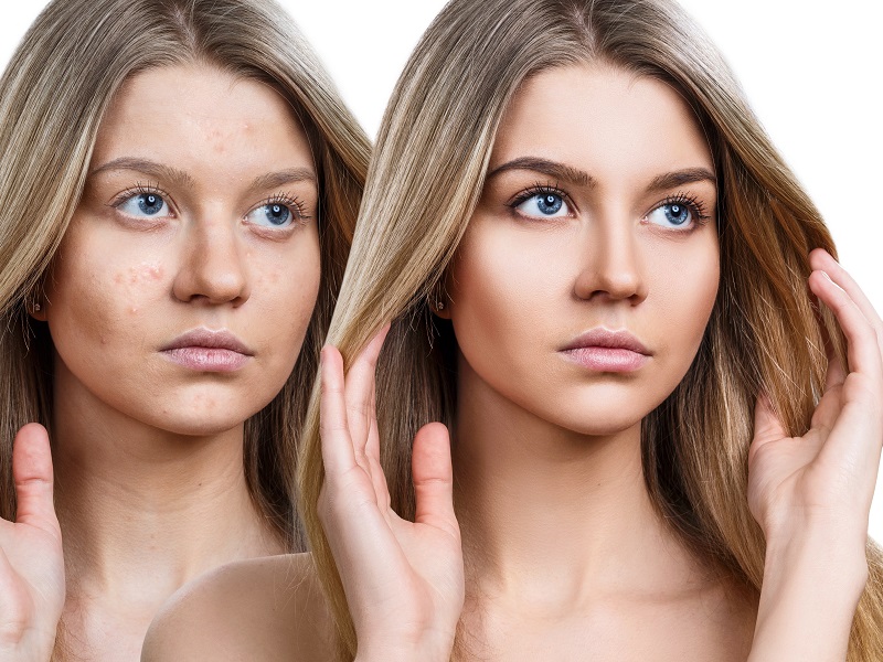 skin-care-for-pollution