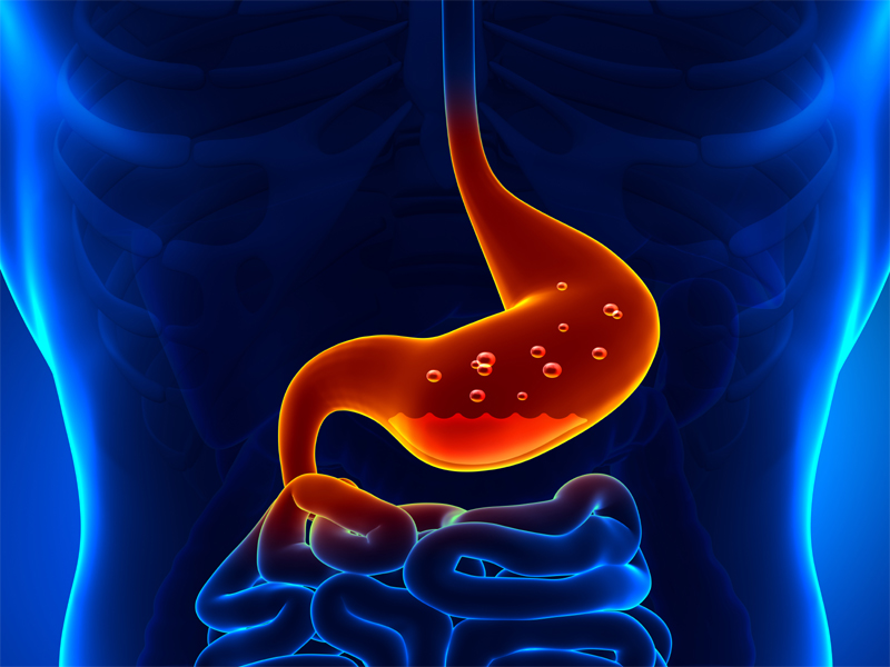 Causes And Symptoms Of Acidity Every One Should Know