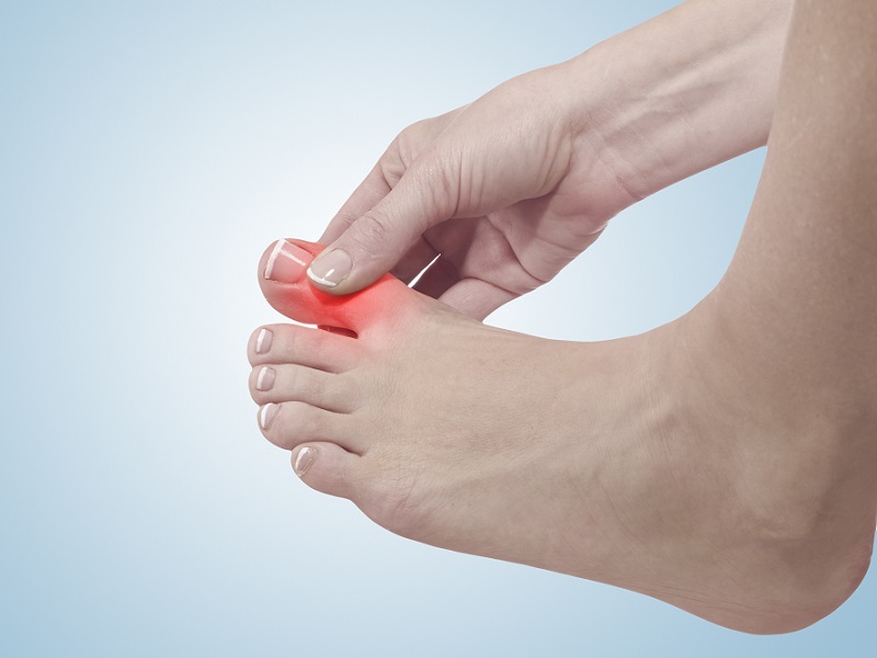 Gout