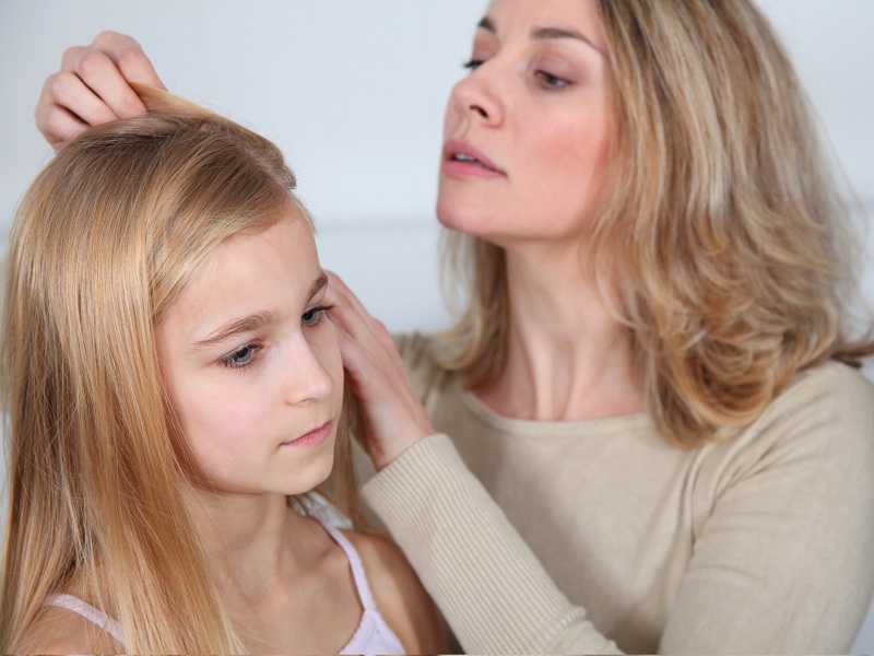 Head lice