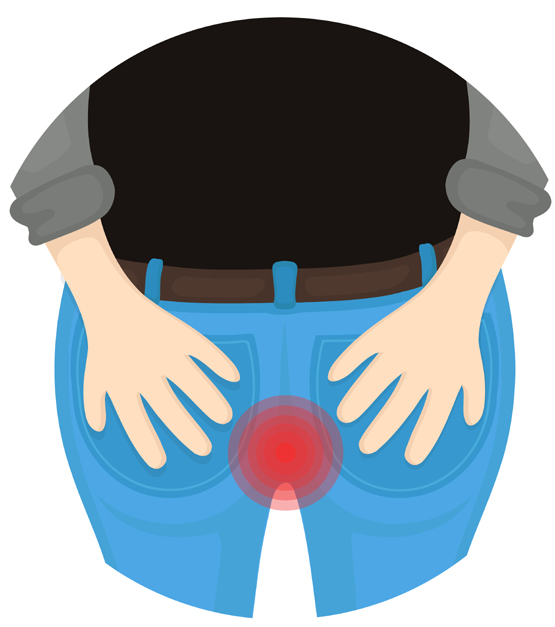 Internal Hemorrhoids Develop Inside