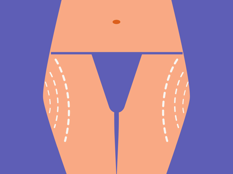 Reduce Saddlebags In 2 Weeks