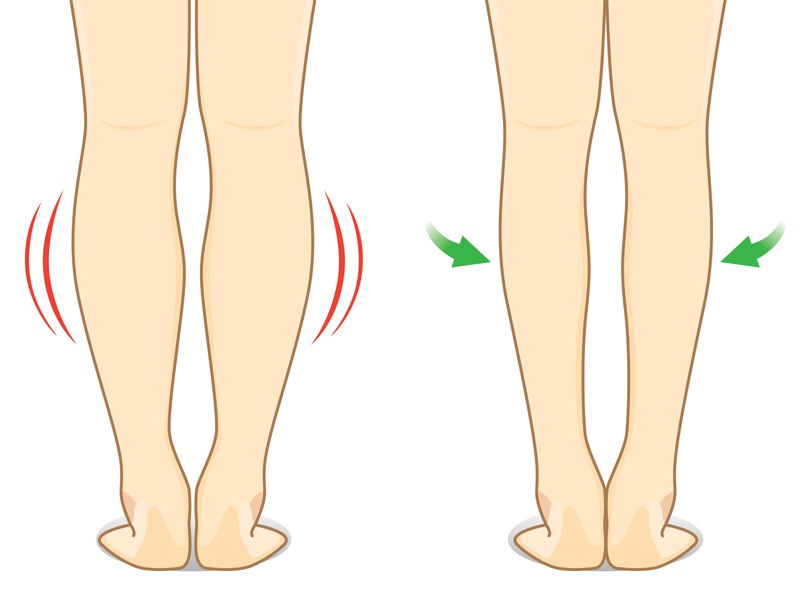 Best Exercises To Reduce Calf Fat