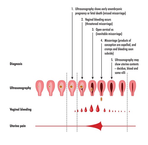 Spotting During Pregnancy 9
