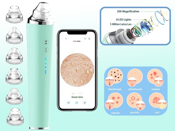 Cleaso's Blackhead Remover and Pore Vacuum