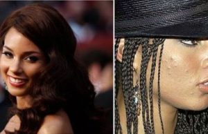 10 Famous Actresses Caught with Pimples On Camera