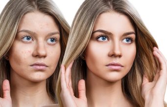 Protect Your Skin from Pollution: Effective Skin Care Tips!
