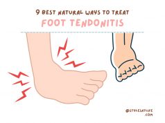 9 Best Natural Ways to Treat Foot Tendonitis at Home