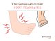 9 Best Natural Ways to Treat Foot Tendonitis at Home