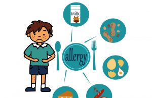 5 Most Common Food Allergy Symptoms!