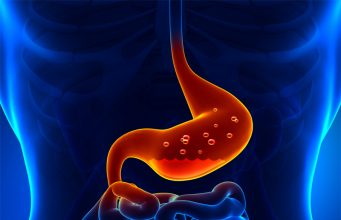 In-Depth Analysis of Acidity: Revealing Its Causes and Symptoms