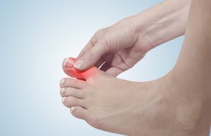 Best Diet For Gout – What To Skip, What To Eat