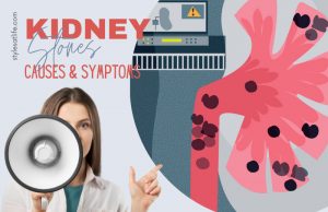 Understanding Kidney Stones: 20 Common Causes and Symptoms